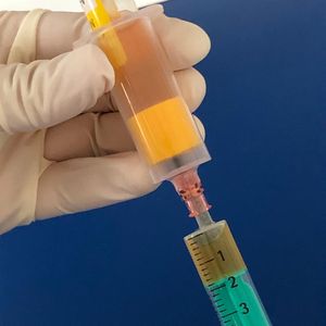 PRP Behandlung